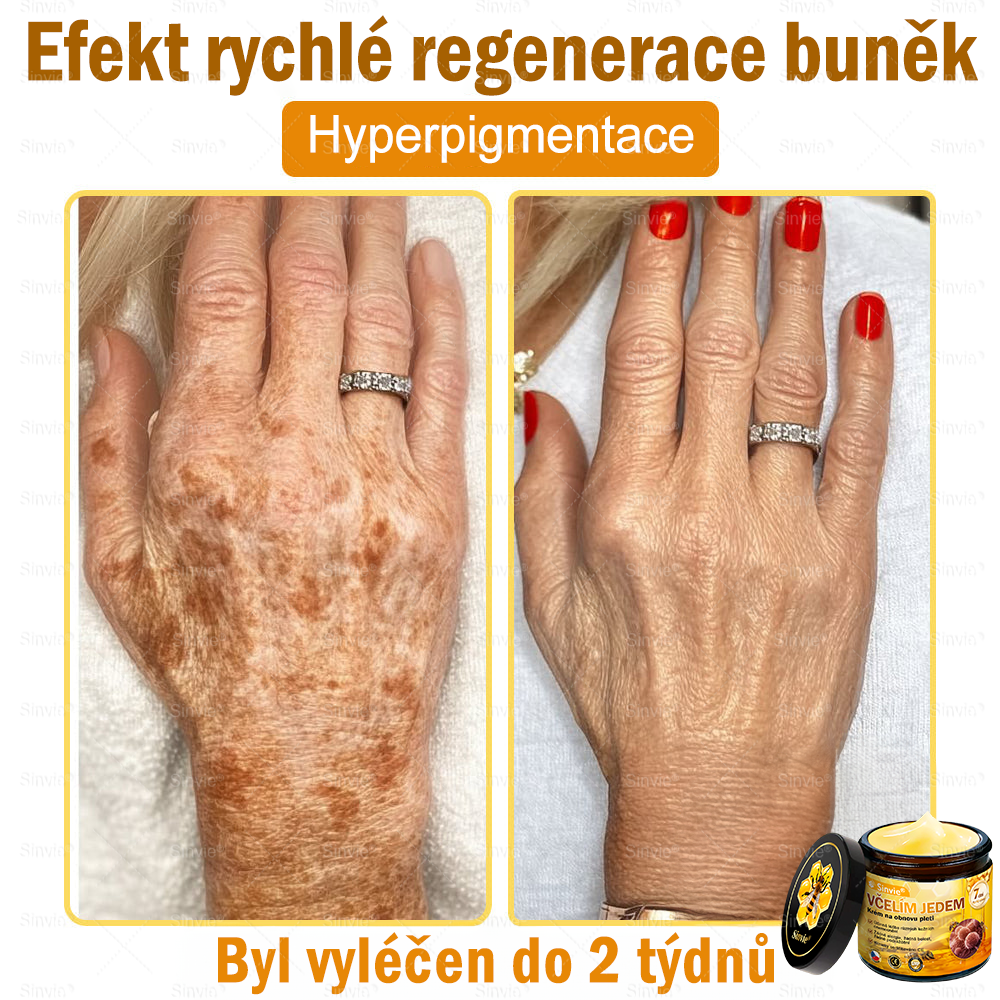 🎈Sinvie® Krém na obnovu pleti s včelím jedem | 50 ml | Doporučeno Českou dermatovenerologickou společností