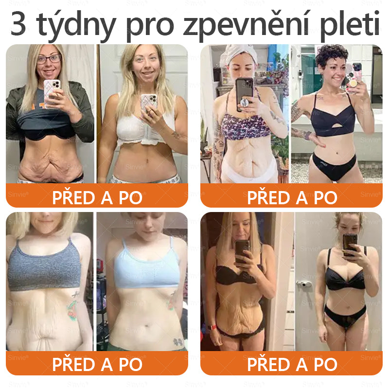 🎁 Zbývá pouze 5 boxů. Nabízíme vám extra 50% slevu! Udržujte si zdravou postavu. Pokud to teď propásnete, příští rok už nebude žádná šance.