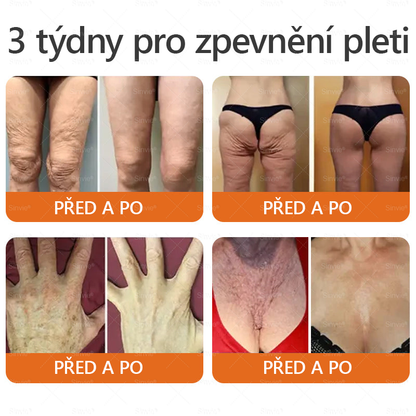 Sinvie® Krém na obnovu pleti s včelím jedem | 50 ml | Doporučeno Českou dermatovenerologickou společností