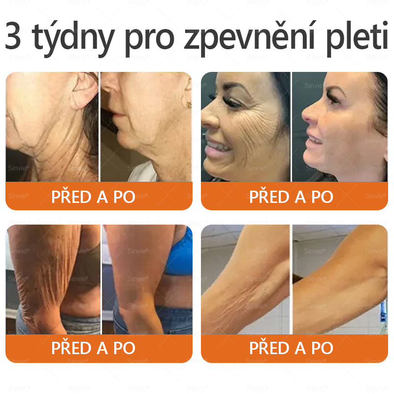 🎈Sinvie® Krém na obnovu pleti s včelím jedem | 50 ml | Doporučeno Českou dermatovenerologickou společností