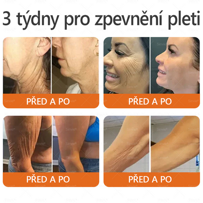 ✨Sinvie® Krém na obnovu pleti s včelím jedem | 50 ml | Doporučeno Českou dermatovenerologickou společností