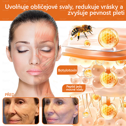 Sinvie® Krém na obnovu pleti s včelím jedem | 50 ml | Doporučeno Českou dermatovenerologickou společností