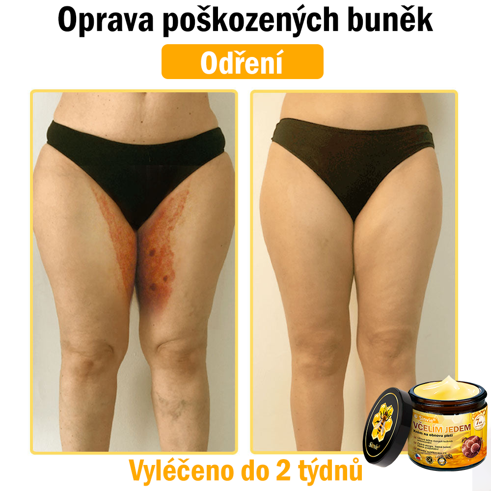 ✨Sinvie® Krém na obnovu pleti s včelím jedem | 50 ml | Doporučeno Českou dermatovenerologickou společností