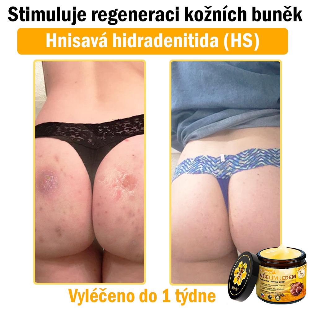 ❤️Sinvie® Krém na obnovu pleti s včelím jedem | 50 ml | Doporučeno Českou dermatovenerologickou společností