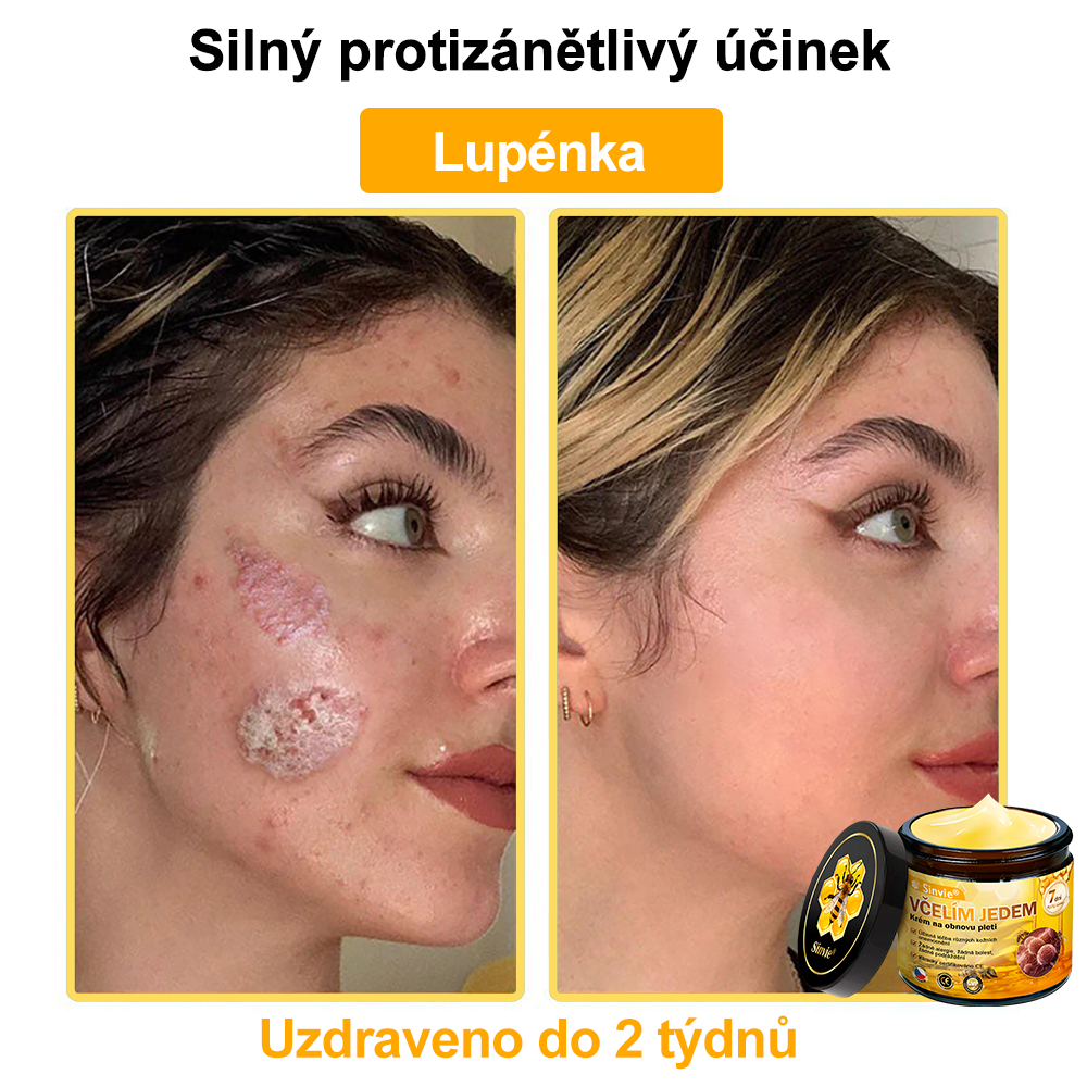 🎁 Zbývá pouze 5 boxů. Nabízíme vám extra 50% slevu! Udržujte si zdravou postavu. Pokud to teď propásnete, příští rok už nebude žádná šance.