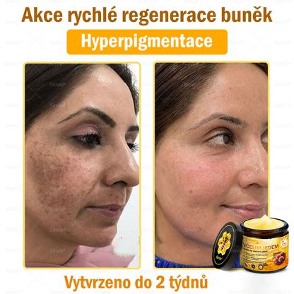 ✨Sinvie® Krém na obnovu pleti s včelím jedem | 50 ml | Doporučeno Českou dermatovenerologickou společností