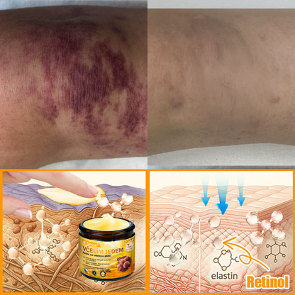 ✨Sinvie® Krém na obnovu pleti s včelím jedem | 50 ml | Doporučeno Českou dermatovenerologickou společností